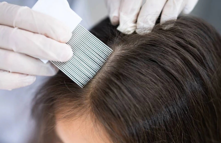 「季节性脱发」怎么办？你需要知道这些方法！